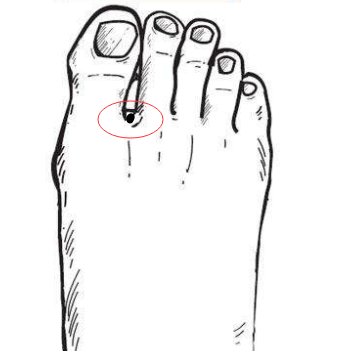 脚趾缝里有痣命运分析（女人右脚底有痣的命运图）